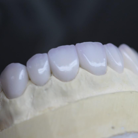 cursos-laborlyra_curta-duracao-Odontologia-Digital