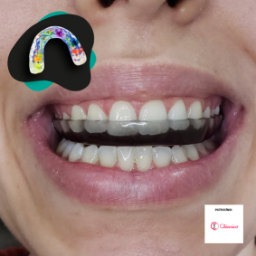 cursos-laborlyra_curta-duracao-placa-miorrelaxante
